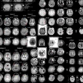 Brain scan x-rays from GAINN.