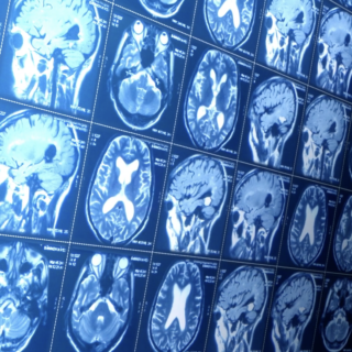 A brain scan from an MRI machine.