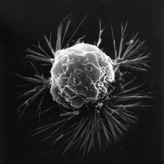 A magnified cancer cell in black and white