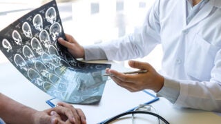 People reviewing brain X-ray