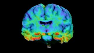 Tau detection in the brain